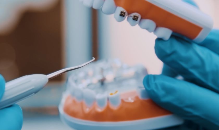 A Guide to Different Cosmetic Dental Procedures