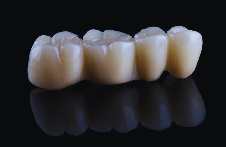 dental crowns what you need to know before you get one